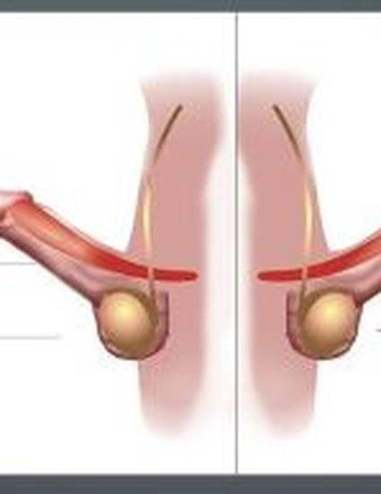 "CARA MEMPERBESAR DAN MEMPERPANJANG PENIS ANDA 7-10 cm ...